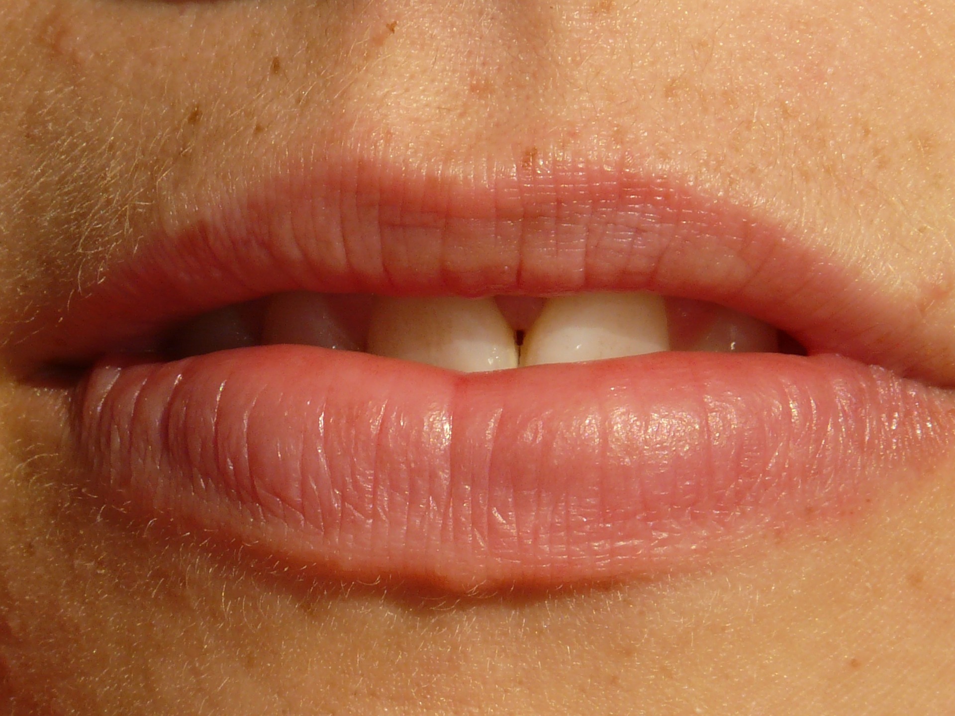 Foto av en avslappnad mun med något särade läppar där framtänderna sticker fram något.